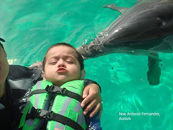 down syndrome dolphin